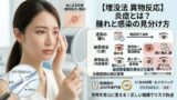 024 double eyelid foreign body reaction