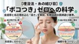 036 double eyelid embedding knot bump